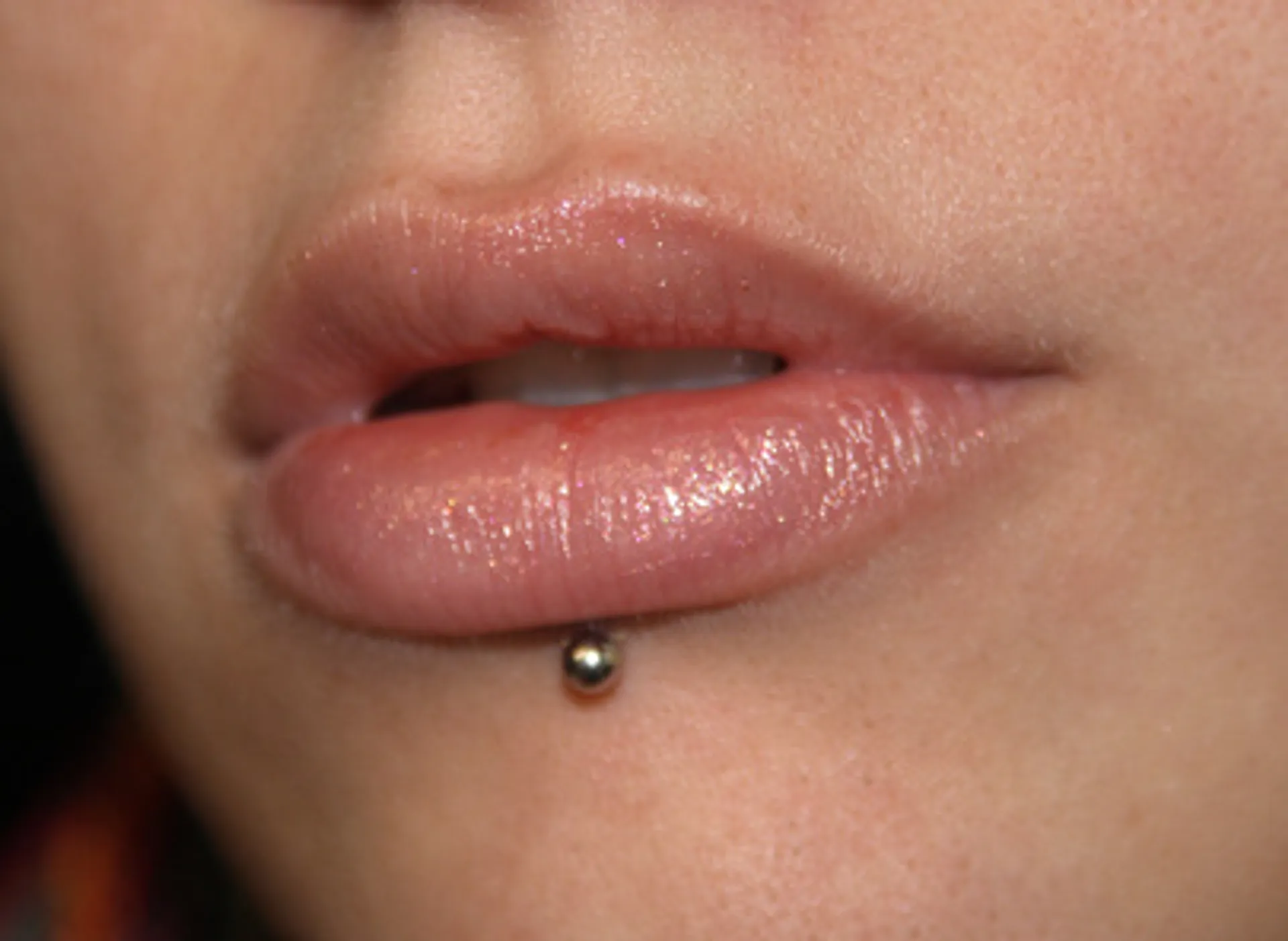 Beitragsbild für den Blogartikel "Piercinglöcher und ausgerissene Ohrlöcher verschließen"