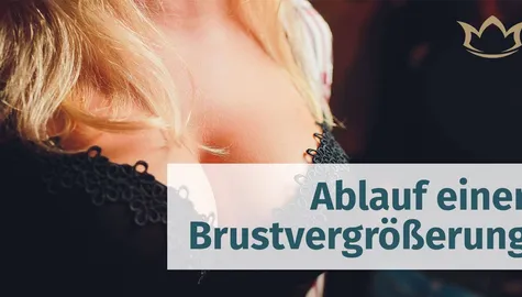 Beitragsbild für den Blogartikel "Ablauf einer Brustvergrößerung"