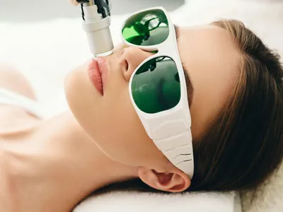 Eine junge Frau bei einer Laserbehandlung für ihr Gesicht.